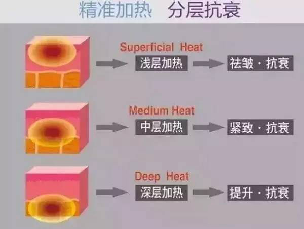 热拉提抗衰理念图解